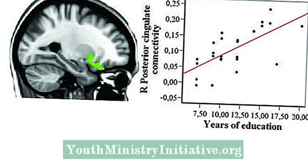 L’analyse cérébrale peut révéler la quantité de travail que vous avez effectué à l’école - Psychothérapie