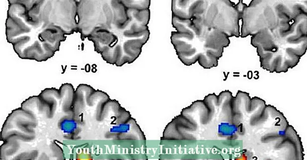 Neuroimaging, Cannabis နှင့် Brain Performance & Function - စိတ်သွင်းပေါ်မှာကုွးခံ