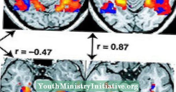મગજના હજારો એફએમઆરઆઈ અભ્યાસો ખામીયુક્ત હોઈ શકે છે - મનોરોગ ચિકિત્સા